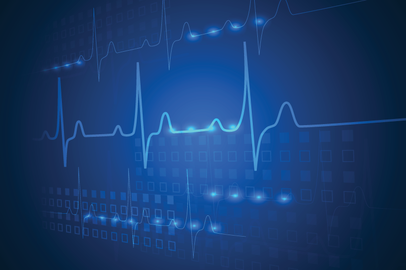 ECG screen showing normal heartbeat
