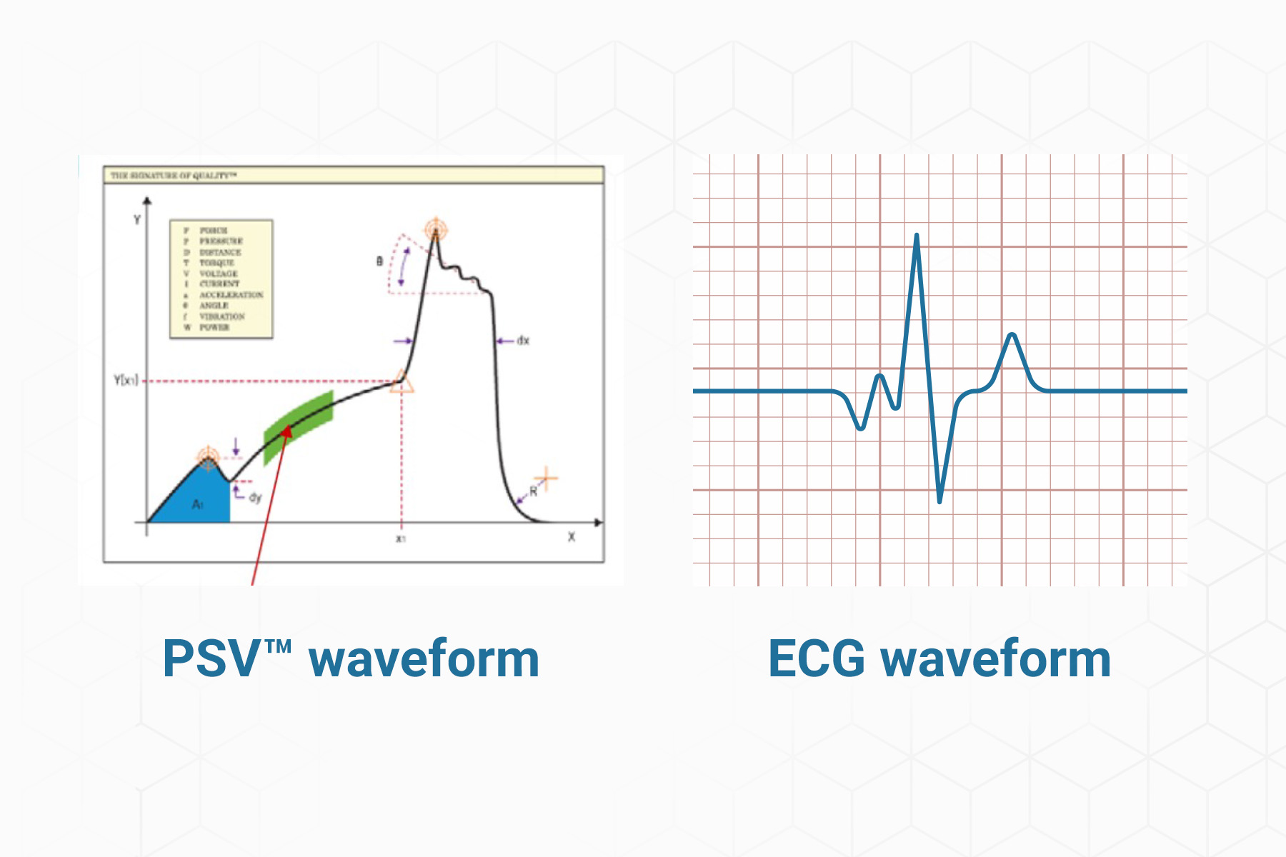 PSV waveform vs. ECG waveform 