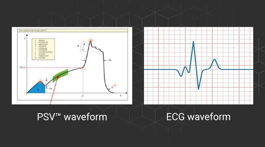 sigPOD PSV vs ECG waveforms 
